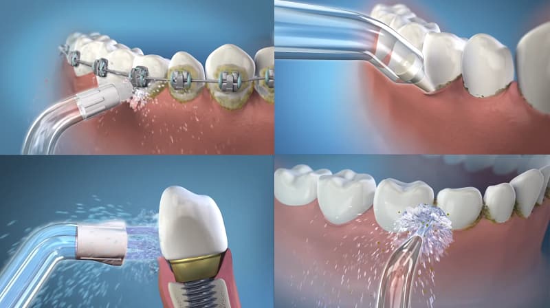 Hướng dẫn cách sử dụng máy tăm nước đúng kỹ thuật