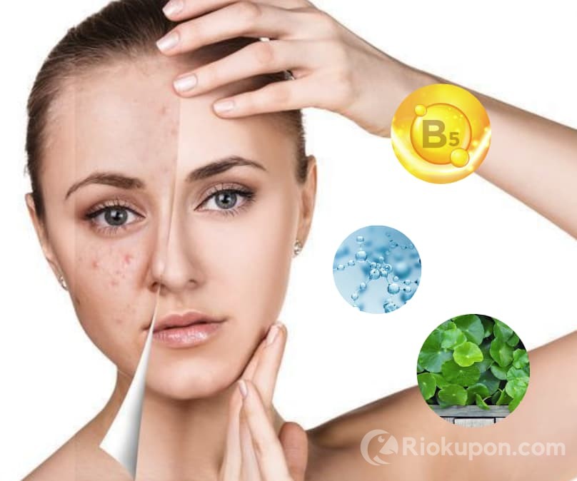 Top 7 thành phần làm dịu da nhạy cảm đang được ưa chuộng trong skincare mà bạn cần biết