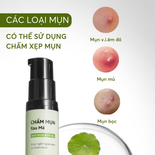 Chấm mụn rau má Cỏ Mềm trị mụn viêm hiệu quả